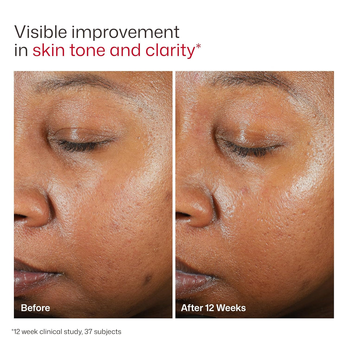 EltaMD UV Clear Face Sunscreen