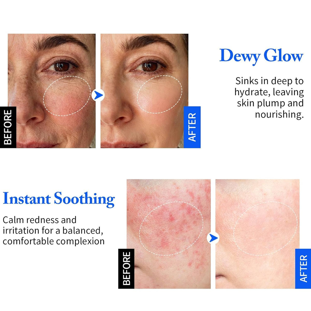 Hyaluronic Acid Face Cream
