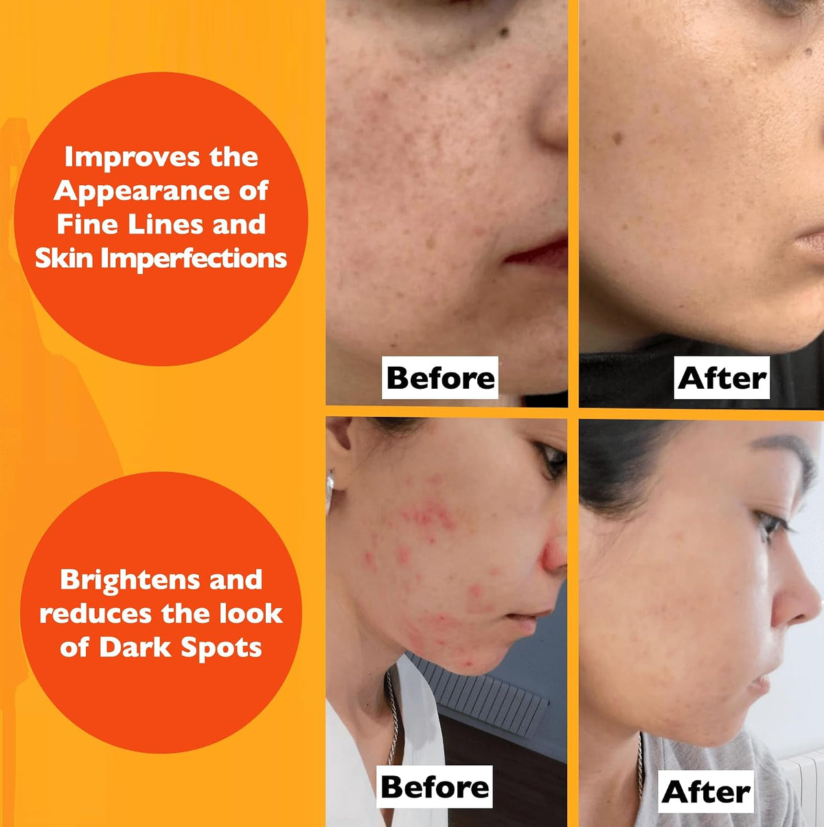 Vitamin C Brightening Face Serum