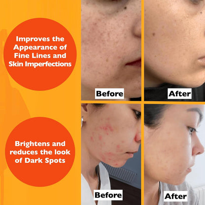 Vitamin C Brightening Face Serum